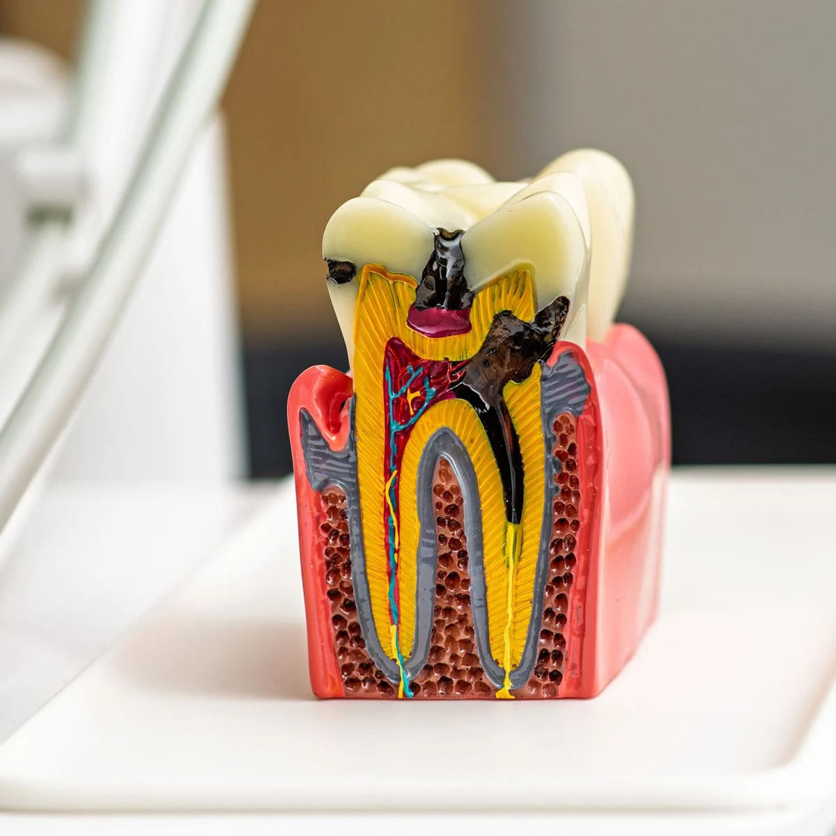 Services - Endodontics