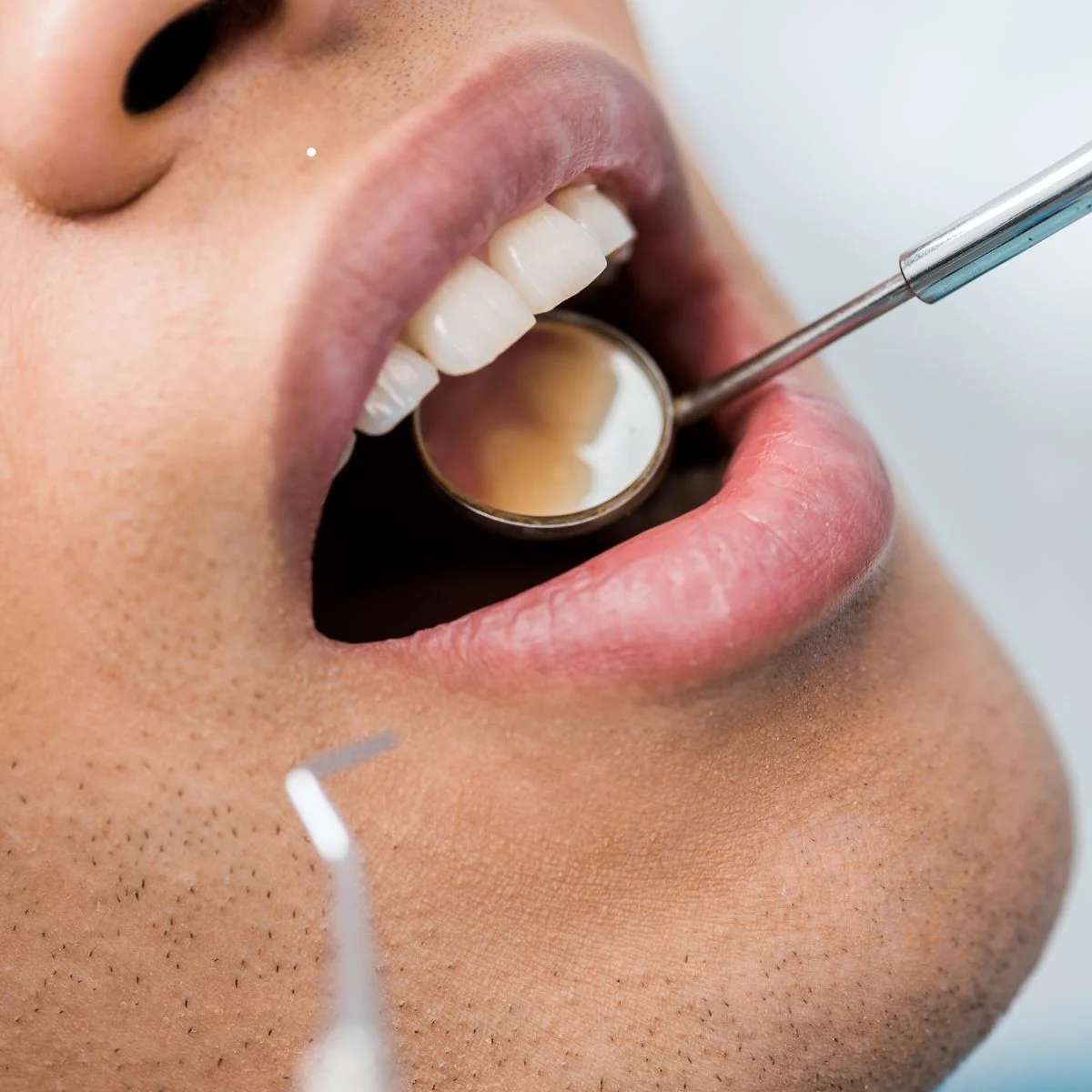Services - Sleep Dentistry for Adults