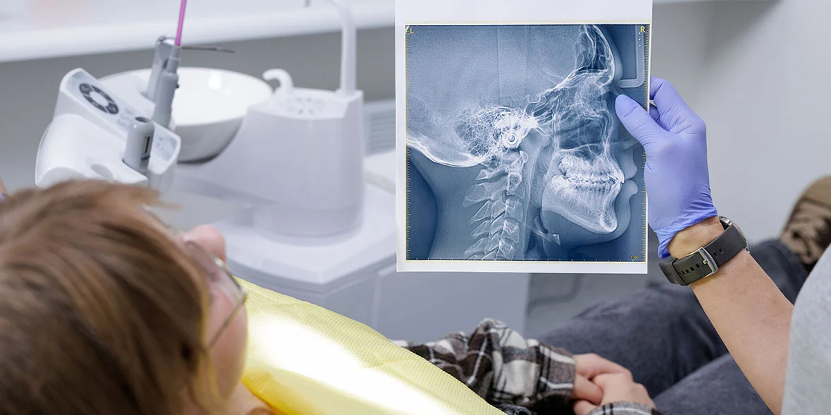 9 Signs Your Wisdom Teeth Need to Come Out – Image 1 9 Signs Your Wisdom Teeth Need to Come Out - Image 1
