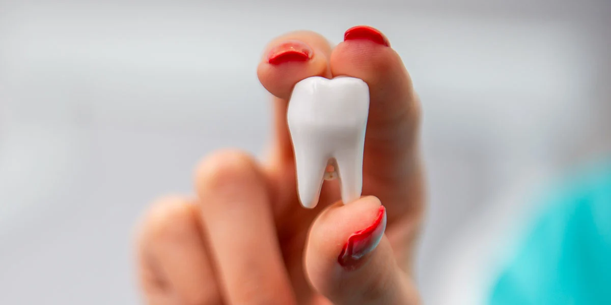 9 Signs Your Wisdom Teeth Need to Come Out – Image 2 9 Signs Your Wisdom Teeth Need to Come Out - Image 2