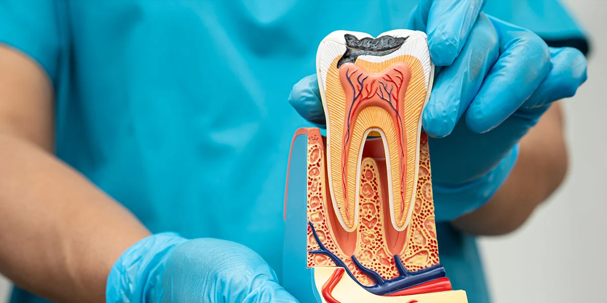 Is a Root Canal Really Painful - Image 1