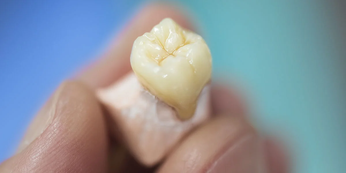 What Is Crown Lengthening and Why Might You Need It – Image 2 What Is Crown Lengthening and Why Might You Need It - Image 2