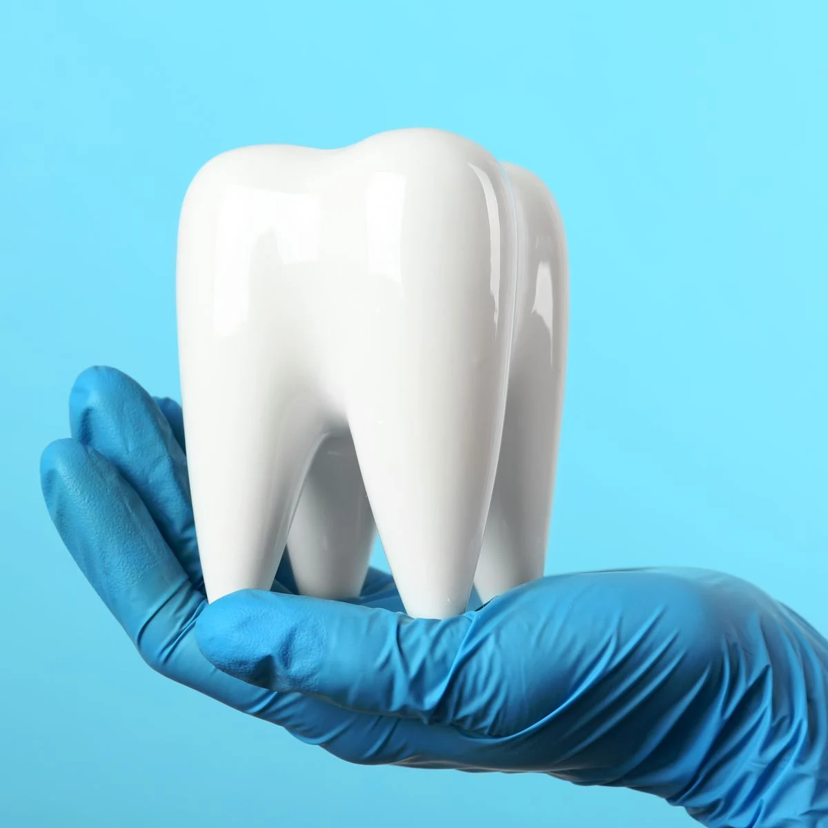 Wisdom Teeth and Extractions – Image 1 Wisdom Teeth and Extractions - Image 1